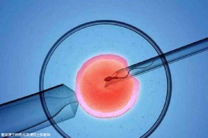 关于爱心供卵代怀助孕咨询哪家好